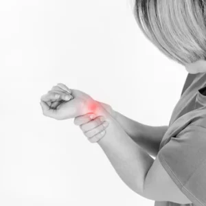 Carpal Tunnel Syndrome