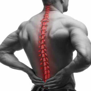 Ankylosing Spondylitis