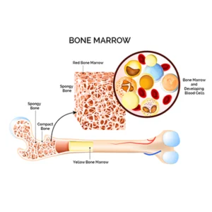 Aplastic Anemia